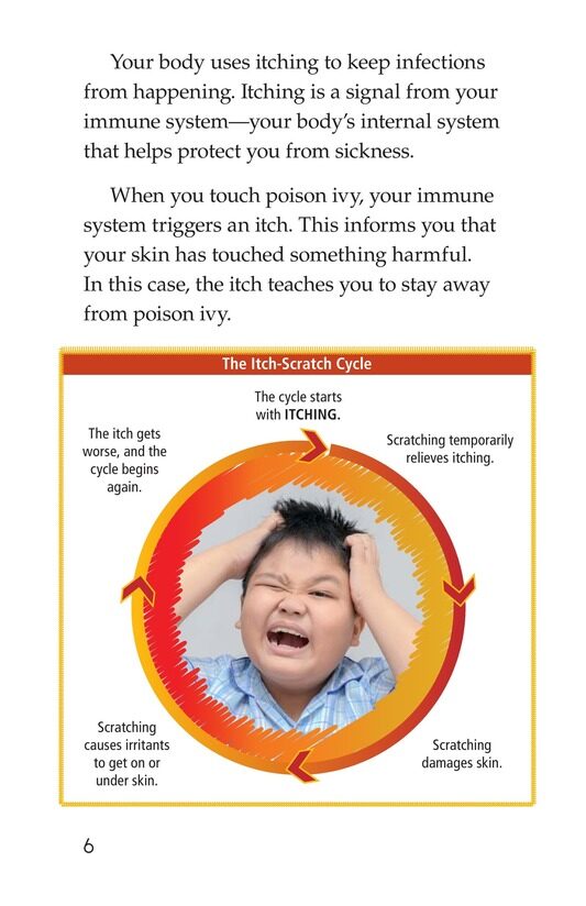 Itching and Scratching绘本故事第5页