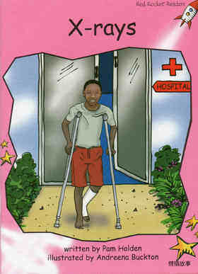 x-rays