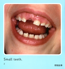 Teeth绘本故事第3页