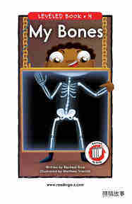 My Bones