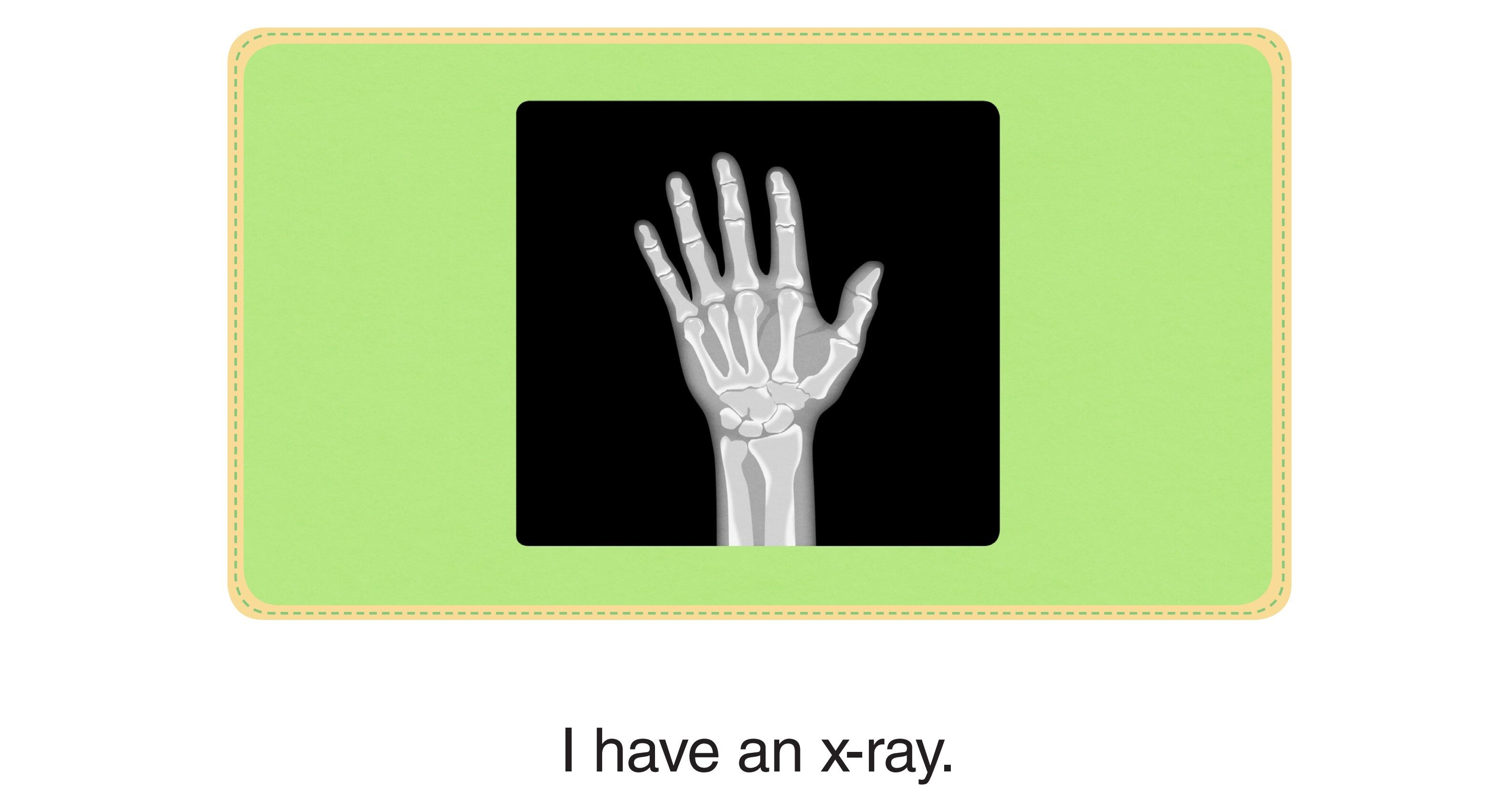 Who Am I -I Have a Tiny Hammer绘本故事第4页