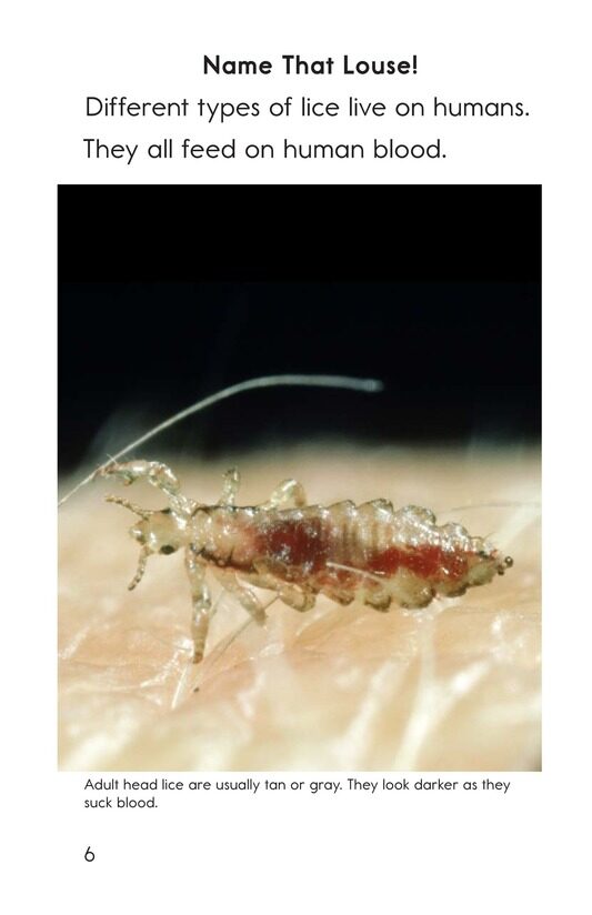 Lice Aren't Nice绘本故事第5页