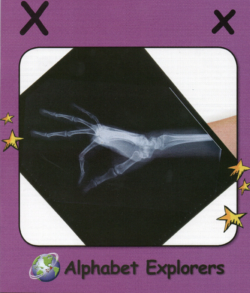 X绘本故事第2页