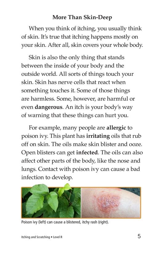 Itching and Scratching绘本故事第4页